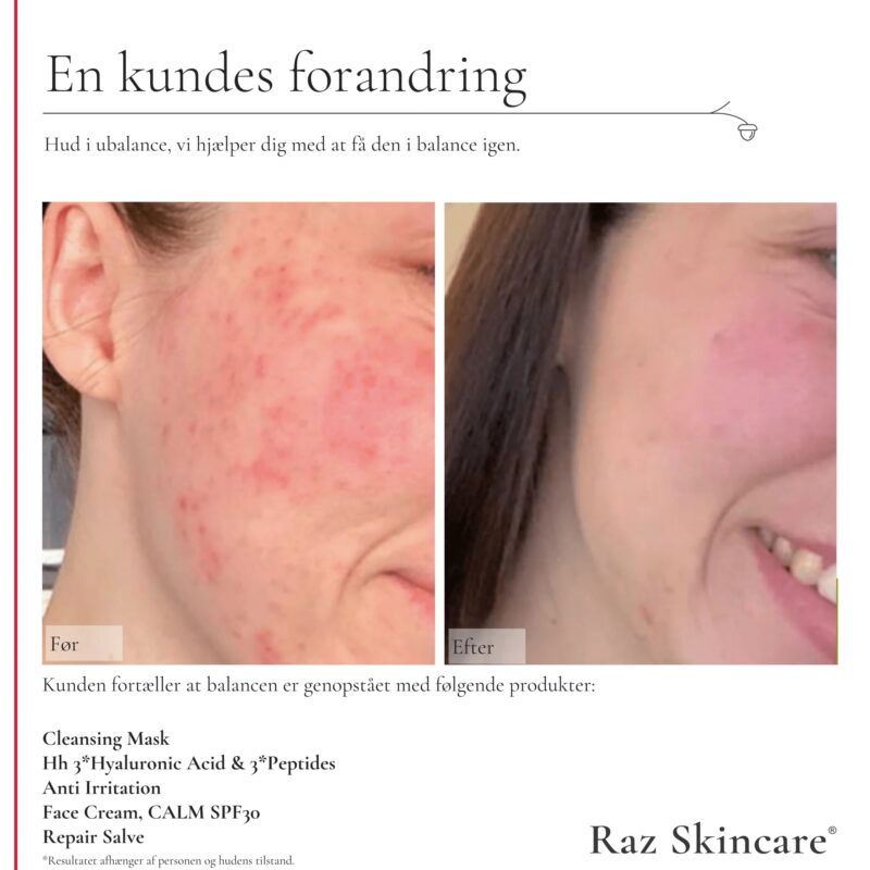 RAZskincare Face Cream Calm spf30 50 ml - Billede 4