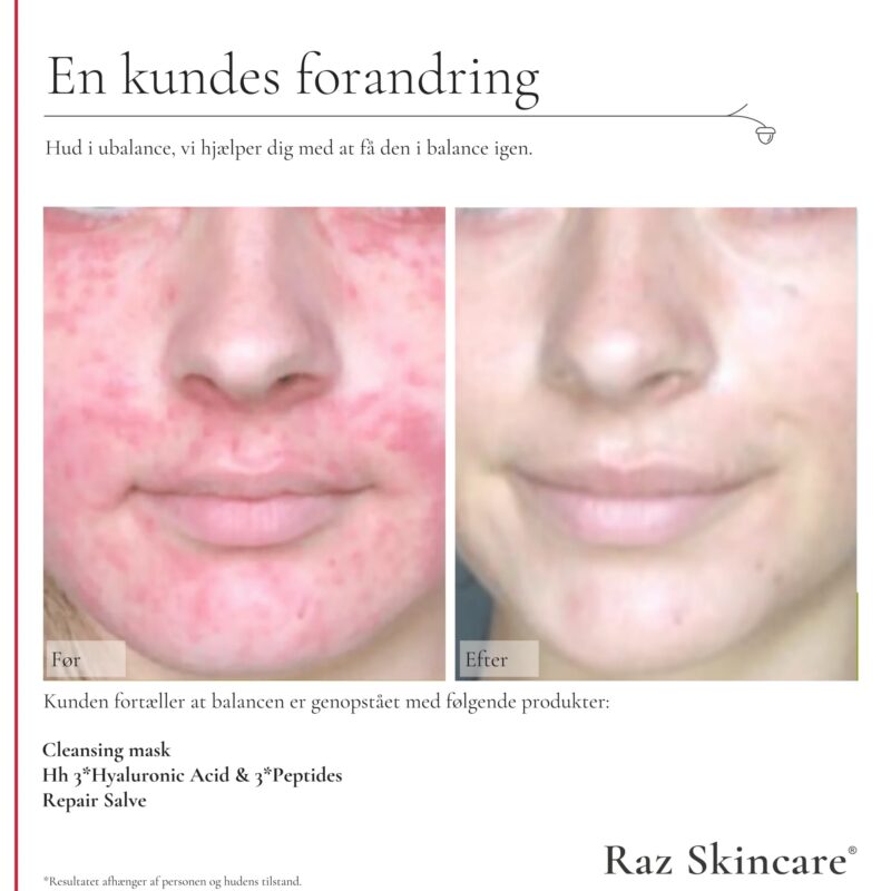 Raz Skincare cleansing maske 200 gr - Billede 4
