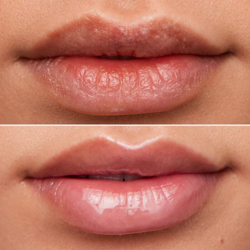 Lip Rehab Serum Oil - clear - Billede 3