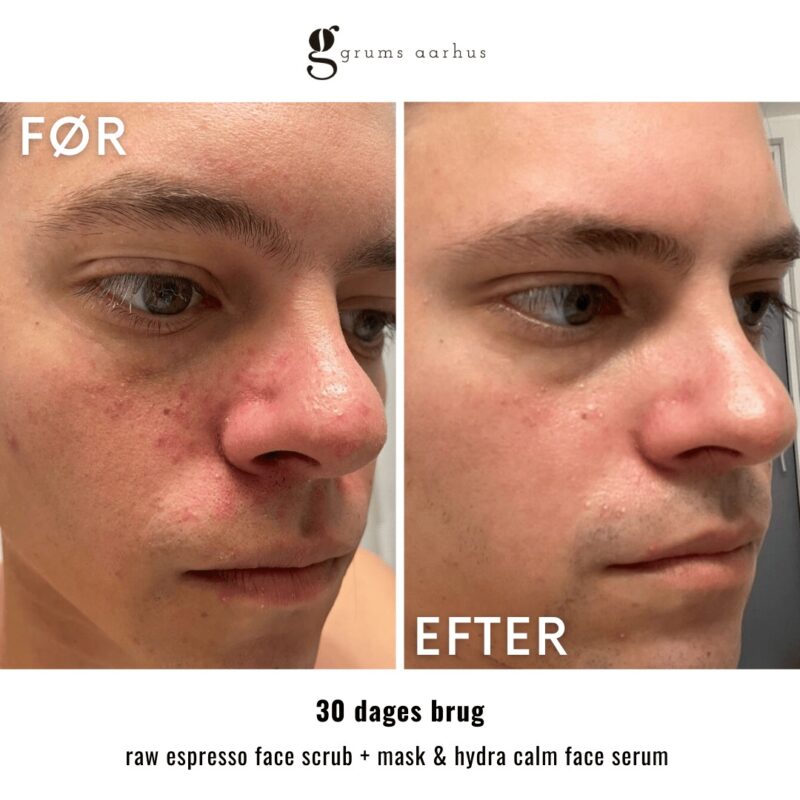 RAW ESPRESSO FACE SCRUB+ MASK 80 ml - Billede 3